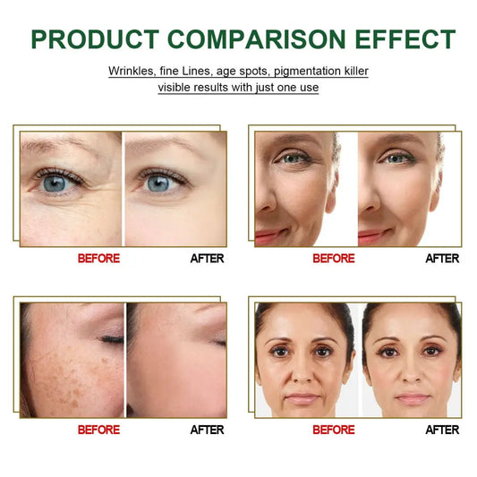 Intensive Anti Aging Essences 30 Day Treatment